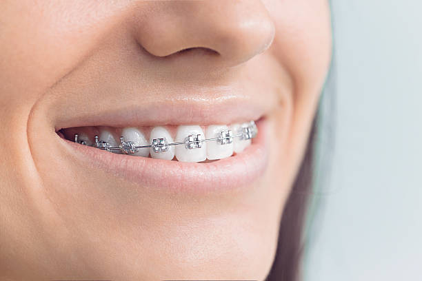 Best Full Mouth Reconstruction  in Silverton, OR